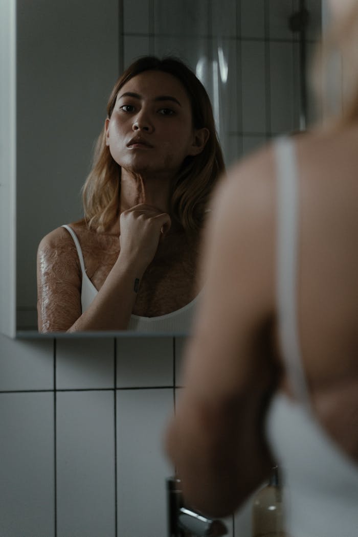 A woman examining her reflection in a mirror, showcasing burn scars, in a dimly lit bathroom.