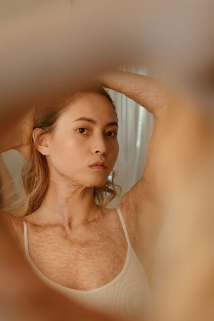 Portrait of an empowered woman embracing her scars with confidence in a mirror reflection.